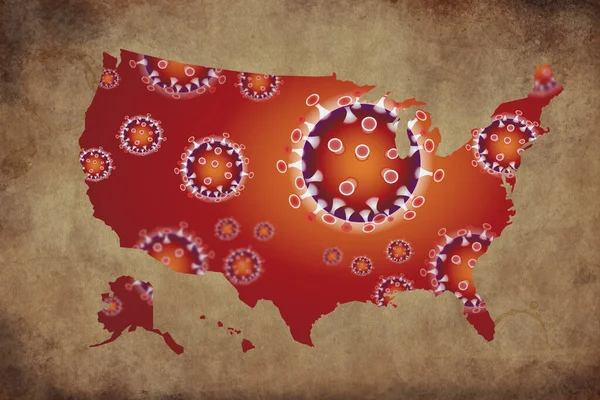 Mapa Del Coronavirus Estados Unidos Estados Unidos Pandemia Virus Epidémico Imágenes de stock libres de derechos