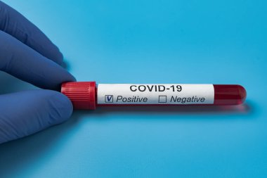 Coronavirus tarafından kirletilmiş biyolojik örnek tüplü bir doktor. Etiket Covid-19. NCoV 2019 'un analizi.