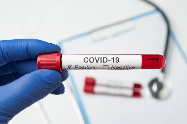 Coronavirus tarafından Covid-19 etiketiyle kirletilmiş biyolojik örnek tüplü bir doktor.