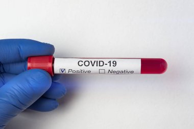Beyaz arka planda Covid-19 etiketli kan testi tutan nitrile eldiven. Pozitif analiz koronavirüsü.