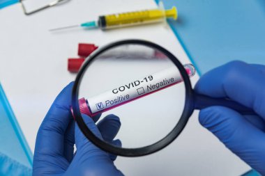 Covid 19 için pozitif kan testi ve bir sıhhiyenin elinde büyüteç. Covid-19 etiketli biyolojik örnek.