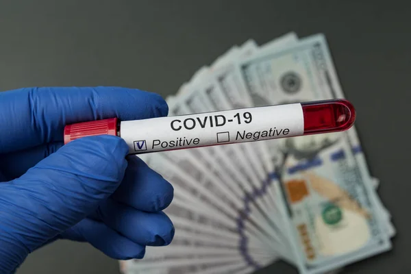 血液Covid 19で医療用手袋保持試験管に手 バックグラウンドでお金 価格分析コロナウイルス — ストック写真