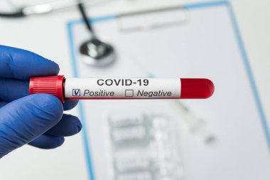 Doktorun elinde Coronavirus tarafından kontamine edilmiş Covid-19 etiketli kan tüpü var. 2019-NCoV için pozitif analiz.