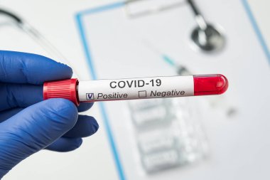 Doktorun elinde koronavirüs enfeksiyonu var. Covid-19 etiketli biyolojik örnek tüpü..