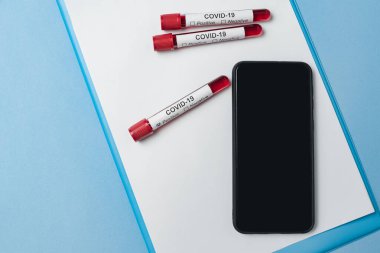 Covid-19 için kan testi tüpü ve boş siyah ekranlı akıllı telefon. Uzayı kopyala Model.
