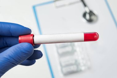 Mikrobiyolog, metnin için üzerinde boş etiket bulunan kanla dolu bir tüp tutuyor. Uzayı kopyala Model.