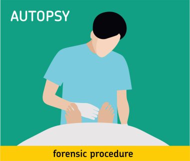 Flat illustration. Autopsy. Forensic procedure clipart