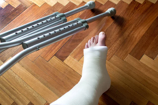 Bein in Gips und Krücken — Stockfoto