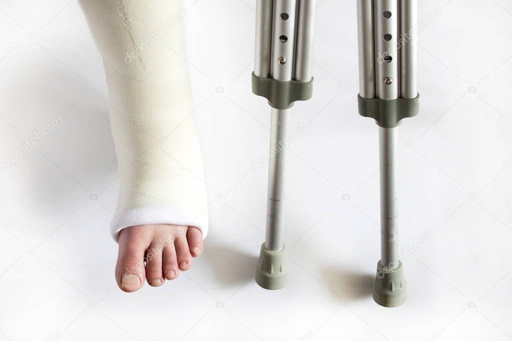 leg in plaster and crutches