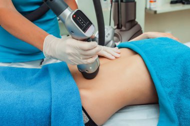 Beyaz eldivenli profesyonel bir dermatoloğun mavi havluyla bir kadının karnına radyofrekans kaldırma işlemi yaparken görüntüsü kesilmiş.