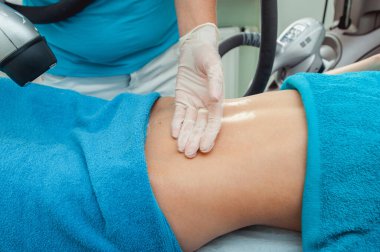 Beyaz eldivenli profesyonel bir dermatoloğun mavi havluyla bir kadının karnına radyofrekans kaldırma işlemi yaparken görüntüsü kesilmiş.