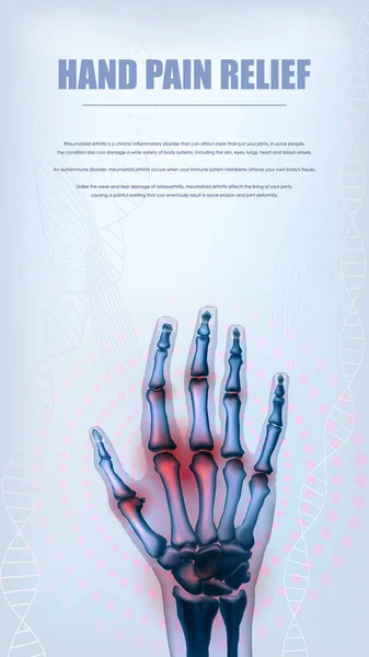 Polyarthrite rhumatoïde verticale articulations douloureuses des mains concept pour les médias sociaux — Image vectorielle