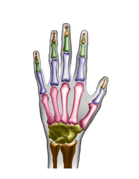 Hand bones with anotations for learning or medical publications. — Stock Photo, Image