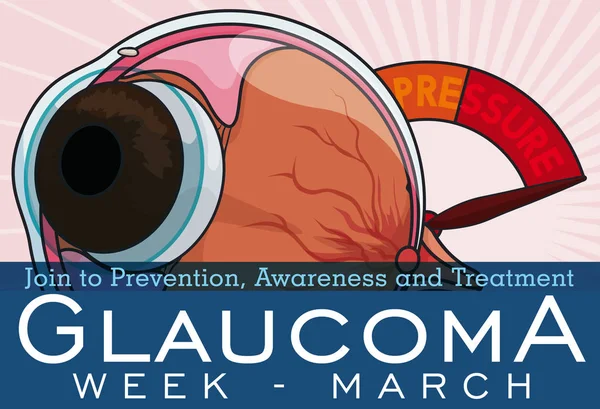 Bulbo oculare con manometro per commemorare la settimana del glaucoma, illustrazione vettoriale — Vettoriale Stock