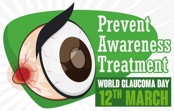 Ojo de dibujos animados que promueve la prevención, la conciencia y el tratamiento en el día del glaucoma, ilustración vectorial — Vector de stock