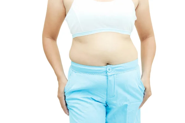 Superfície abdominal da mulher gorda — Fotografia de Stock