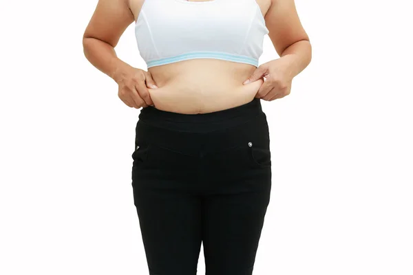 뚱뚱한 여자의 복 부 표면 — 스톡 사진