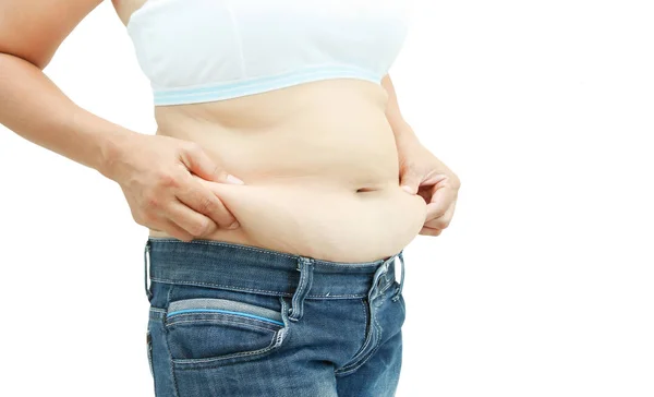 Abdominal surface of fat woman — Stock Photo, Image