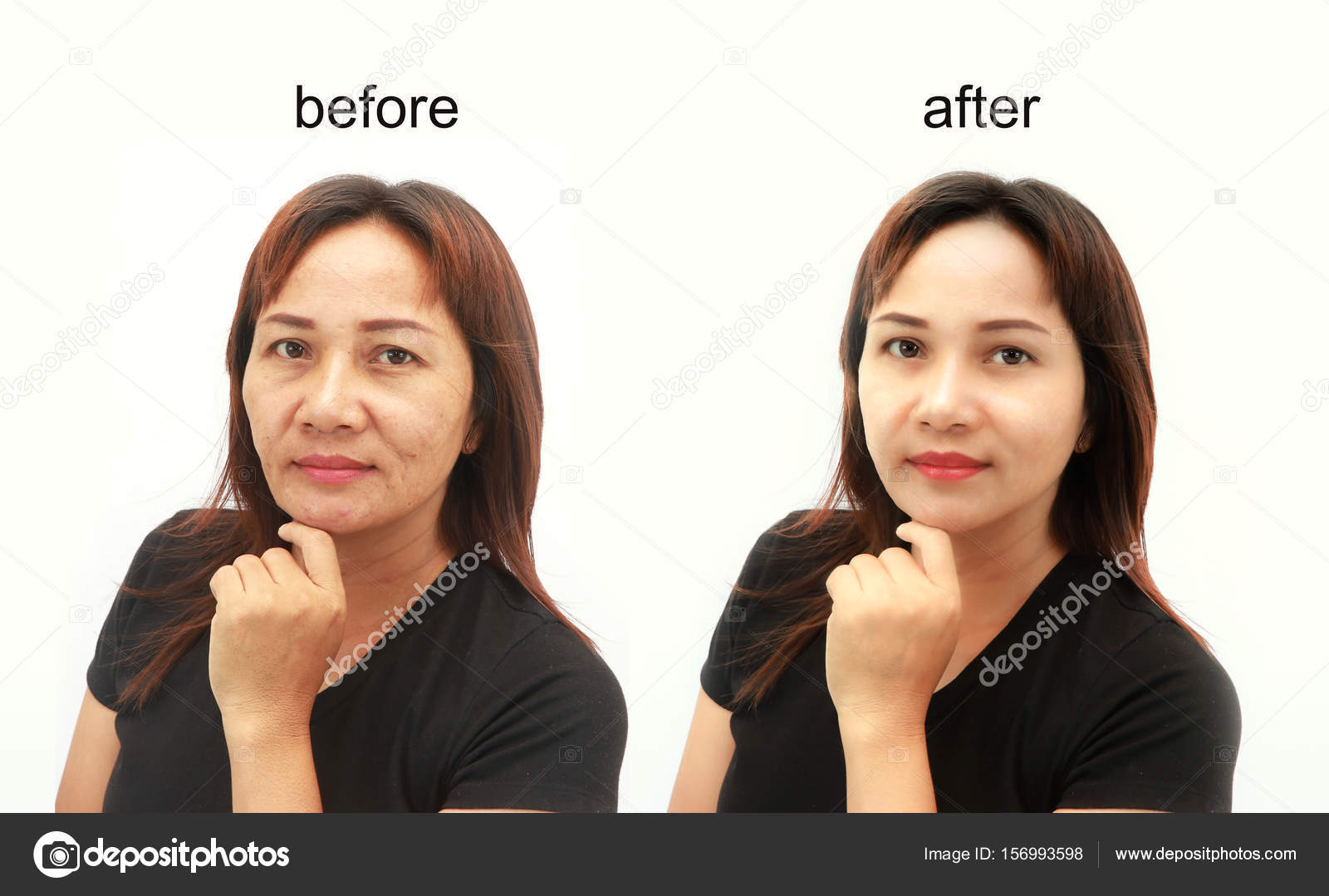 Asian women on sale plastic surgery