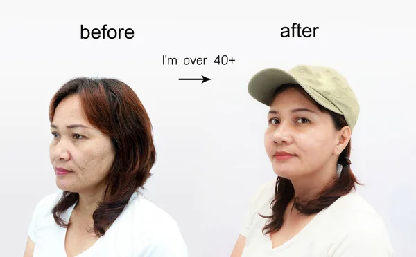 Asian Middle Aged Woman Retouch Concept Makeup Plastic Surgery — Stock Photo, Image
