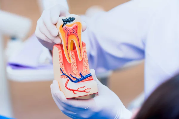Tandarts Met Tanden Implanteren Valse Tanden Tandheelkunde Gezondheidszorg Concept Tandheelkundige — Stockfoto