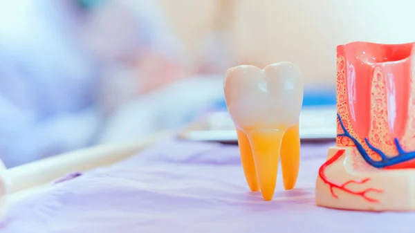 Implante Dentário Dentes Falsos Conceito Odontologia Saúde Clínica Dentária — Fotografia de Stock