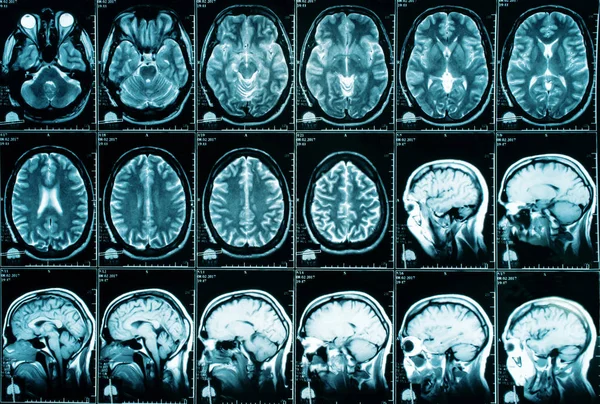 X-ray image of the brain computed tomography