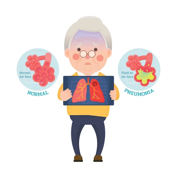 Komuta sizde pnömoni sahip