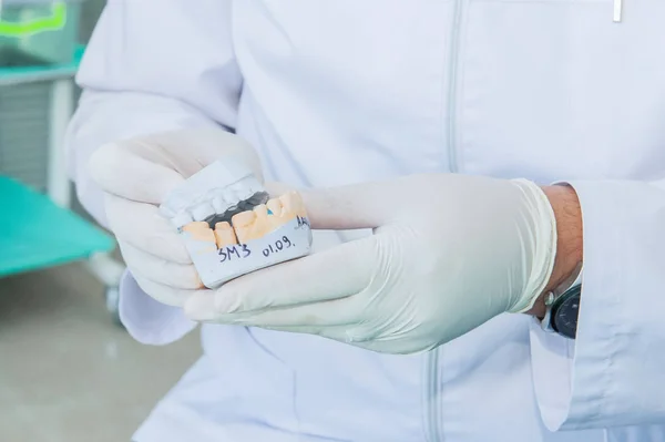 Gloved dentist's hand holding dental gypsum model — Stock Photo, Image