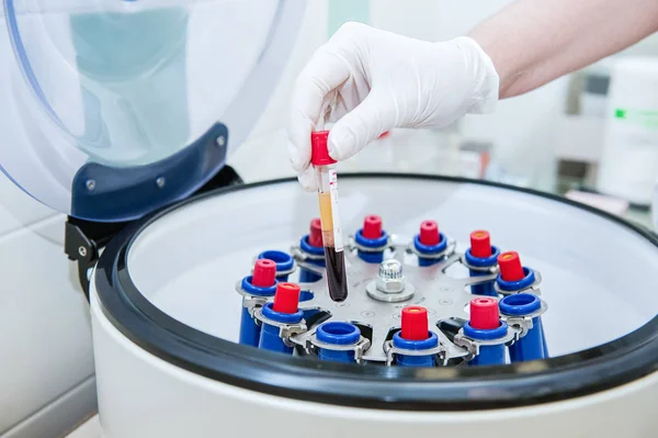 Doctor hand in medical glove with clinical chemistry samples putting them to centrifuge — Stock Photo, Image