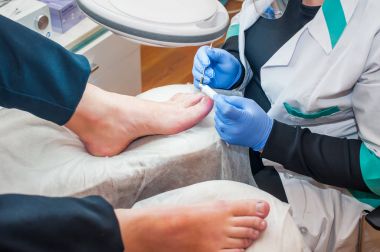 Podoloji tedavisi. Ayak tırnağı mantarını tedavi eden pediatrist. Doktor nasırları, nasırları ve içe göçmüş tırnağı alıyor. Donanım manikürü. Sağlık, vücut bakımı konsepti. Seçici odak