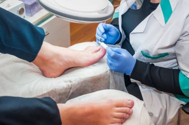 Podology treatment. Podiatrist treating toenail fungus. Doctor removes calluses, corns and treats ingrown nail. Hardware manicure. Health, body care concept. Selective focus clipart