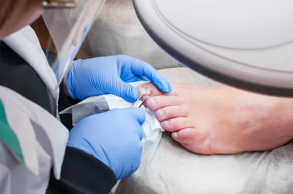 Podológiai kezelés. Podiatrist kezelésére lábköröm gomba. Az orvos eltávolítja a bőrkeményedéseket, kukoricát és kezeli a benőtt körmöt. Hardver manikűr. Egészség, testápolás. Szelektív fókusz — Stock Fotó