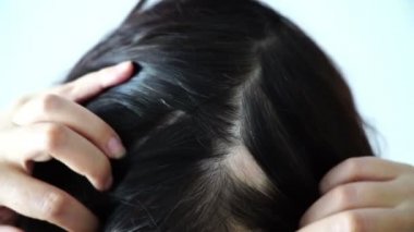 saç dökülmesi kadın saç kaybı kadın yüksek tapınak başından arkasına dokunmadan eller tarafından bulundu