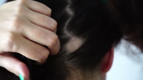 Hajhullás a nők haj veszteség nő található magas templom vissza a fejét a kezében, megható — Stock videók