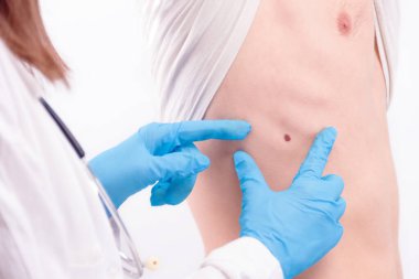 Onkolojik hastalık konsepti. Eldivenli beyaz önlük ve steteskop giyen doktor erkek derisindeki melanomu inceliyor..