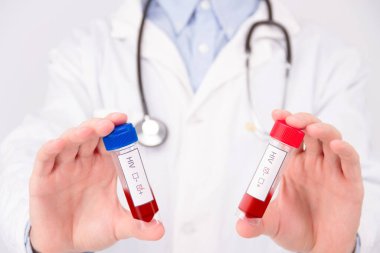 AIDS / HIV hastalığı konsepti. Aids / Hiv ve steteskopta pozitif ve negatif tümör işaretleyicisi / kan testi olan kırmızı kurdeleli beyaz önlük giyen doktor..