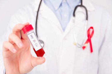 AIDS / HIV hastalığı konsepti. Aids / HIV sembolü olarak kırmızı kurdeleli beyaz önlük ve mavi kauçuk eldiven giyen doktor ve steteskopta tümör işareti / kan testi pozitif çıktı..