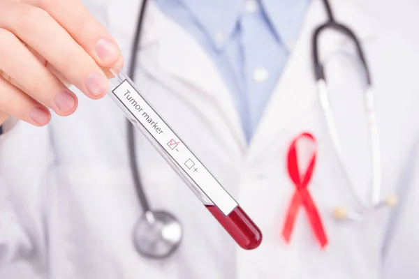 Onkológiai Betegség Koncepció Orvos Fehér Köpenyt Visel Piros Szalaggal Aids — Stock Fotó