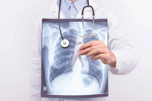 Oncological Lung Cancer Disease Concept Homme Mâle Tenant Corps Médical — Photo