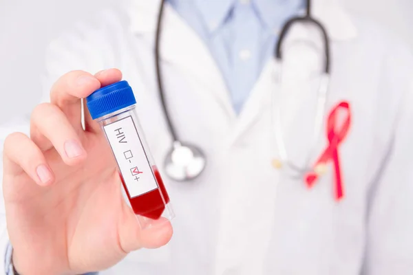 Aids Hiv Betegség Koncepció Orvos Fehér Köpenyt Kék Gumikesztyűt Visel — Stock Fotó