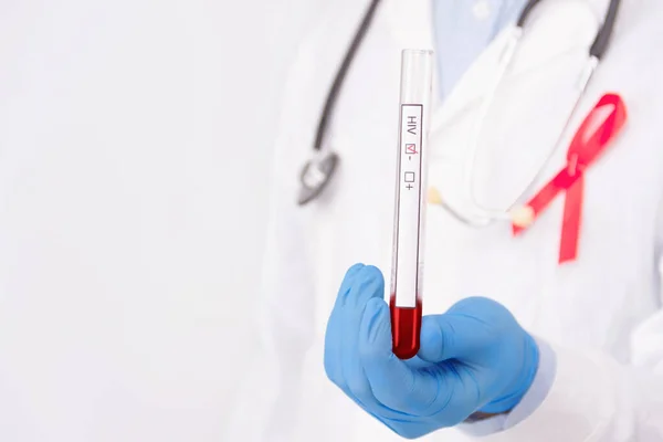 Sicheres Sexuelles Gesundheitswesen Arzt Trägt Weißen Mantel Mit Roter Schleife — Stockfoto