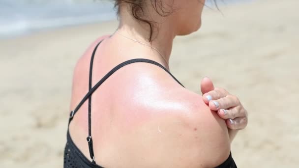 Woman Applying Sunscreen Shoulder She Sunburned Keep Getting Worse — Stock Video