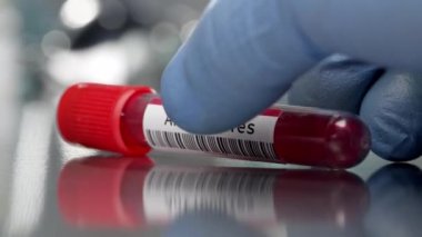 Tıbbi laboratuvara yerleştirilen antikor şişesi yavaşça dönerken....