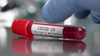 Covid-19 SARS-Cov-2 antikor şişesi tıp laboratuarına yerleştirildi..