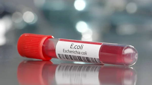 Hetteglass Med Coli Escherichia Coli Antistoffer Medisinsk Laboratorium – stockfoto