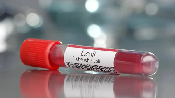 E.coli Escherichia coli antikor şişesi tıbbi laboratuarda.