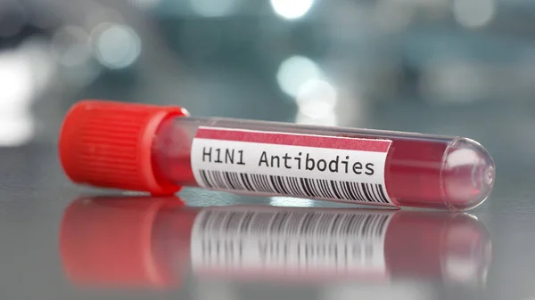 H1N1 Vasta Aineinjektiopullo Lääketieteellisessä Laboratoriossa — kuvapankkivalokuva