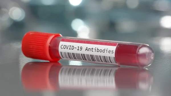 Covid Coronavirus Vasta Aineita Sisältävä Injektiopullo Lääketieteellisessä Laboratoriossa kuvapankkikuva