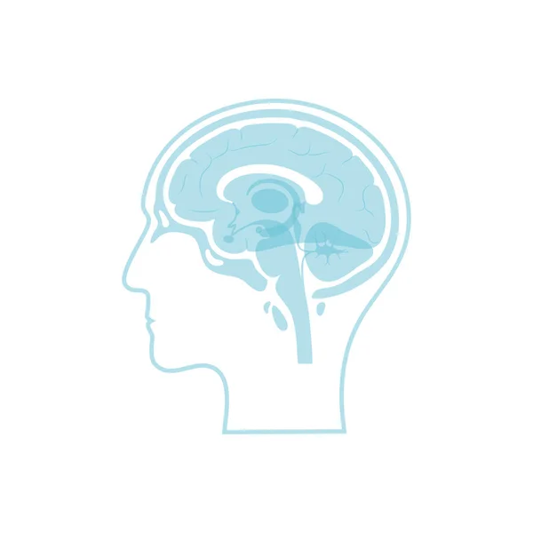 Векторная иллюстрация трупной мозоли — стоковый вектор
